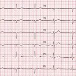 ECG-12-derivazioni