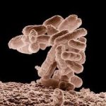 escherichia coli