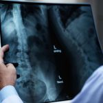 radiografia