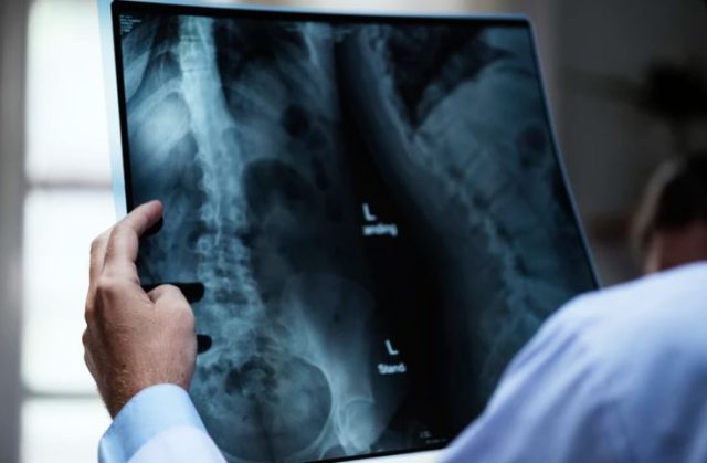 radiografia