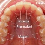 Arcata dentale