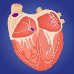 Dp sistema di conduzione cardiaco