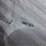 RX-pacemaker-senza-fili-PW