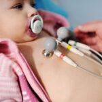 ECG bimbo Dph (1)